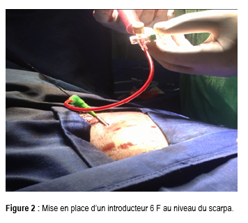 Figure2