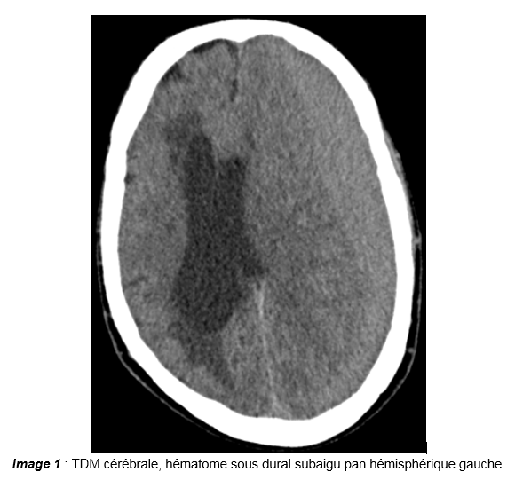 Image1