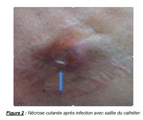 Figure2
