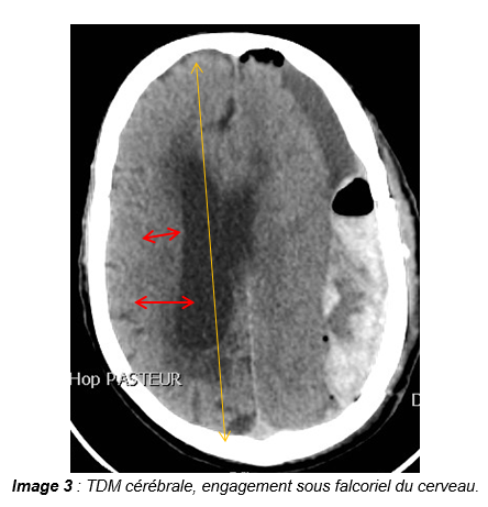 Image3 Image3