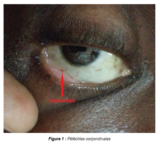 Figure1 Figure1
