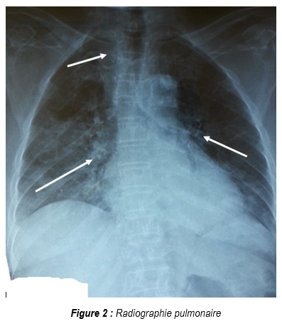Figure2 Figure2