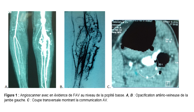 Figure1