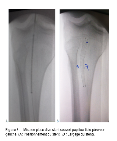 Figure3