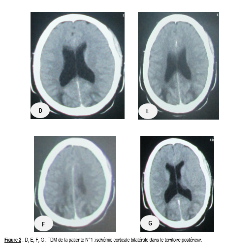 Figure2 Figure2